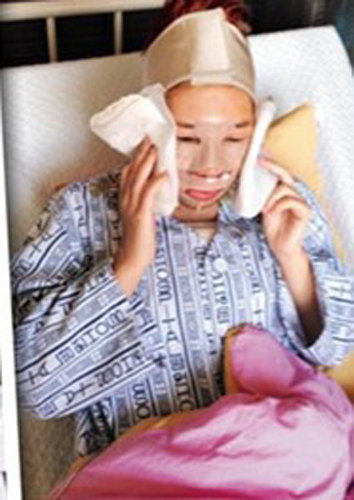 《喜爱夜蒲》女星整容肿至猪头痛不欲生