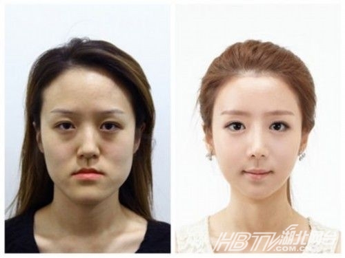 韩国双胞胎整容逆袭+丑女大翻身美呆了惊艳网友