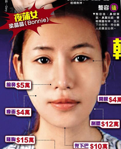 《喜爱夜蒲》女星整容肿至猪头痛不欲生