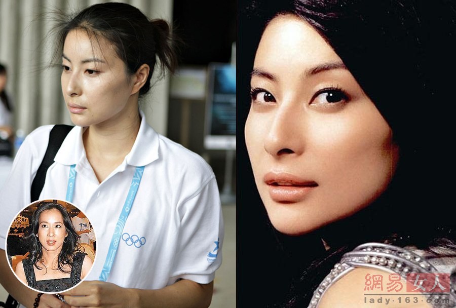 王菲 颧骨高 林志玲大鼻孔揭 女星 身上的不足