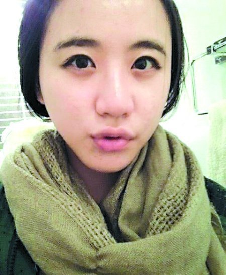 新型眼保健操翻白眼女孩称视频摄于十年前